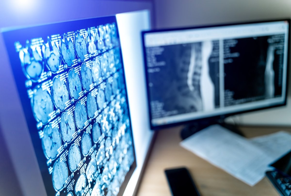 TC in oncologia: pubblicate le prime raccomandazioni europee