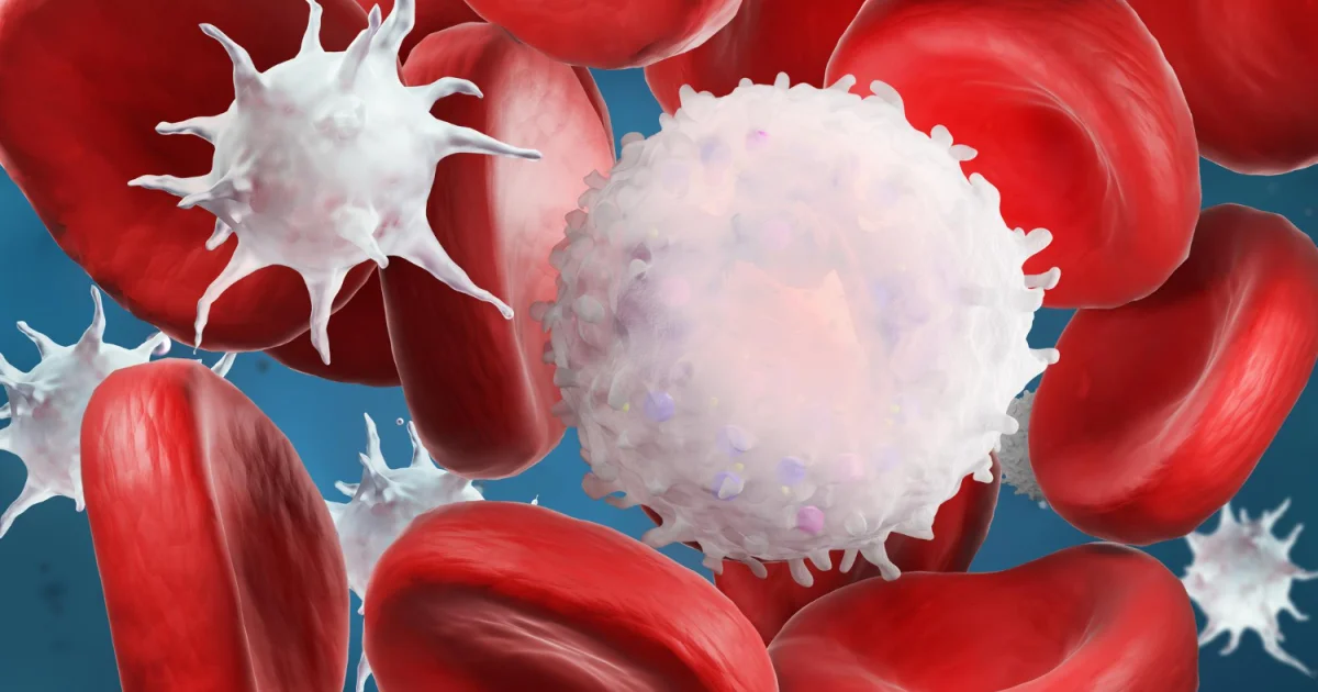 Leucemia linfoblastica acuta, l’immunoterapia entra prima nella cura